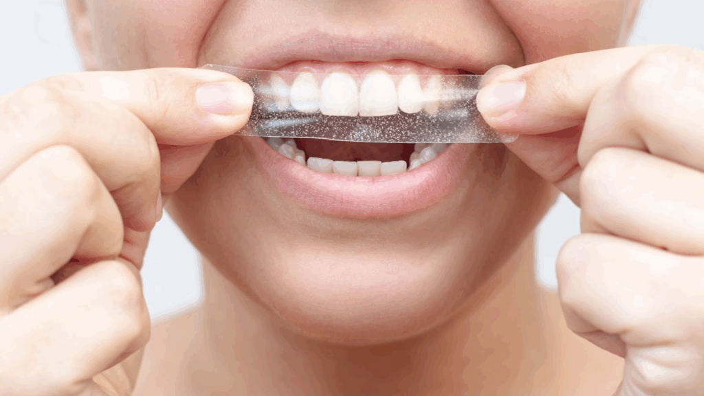 Teeth Bleaching Prep: What to Know Before You Whiten