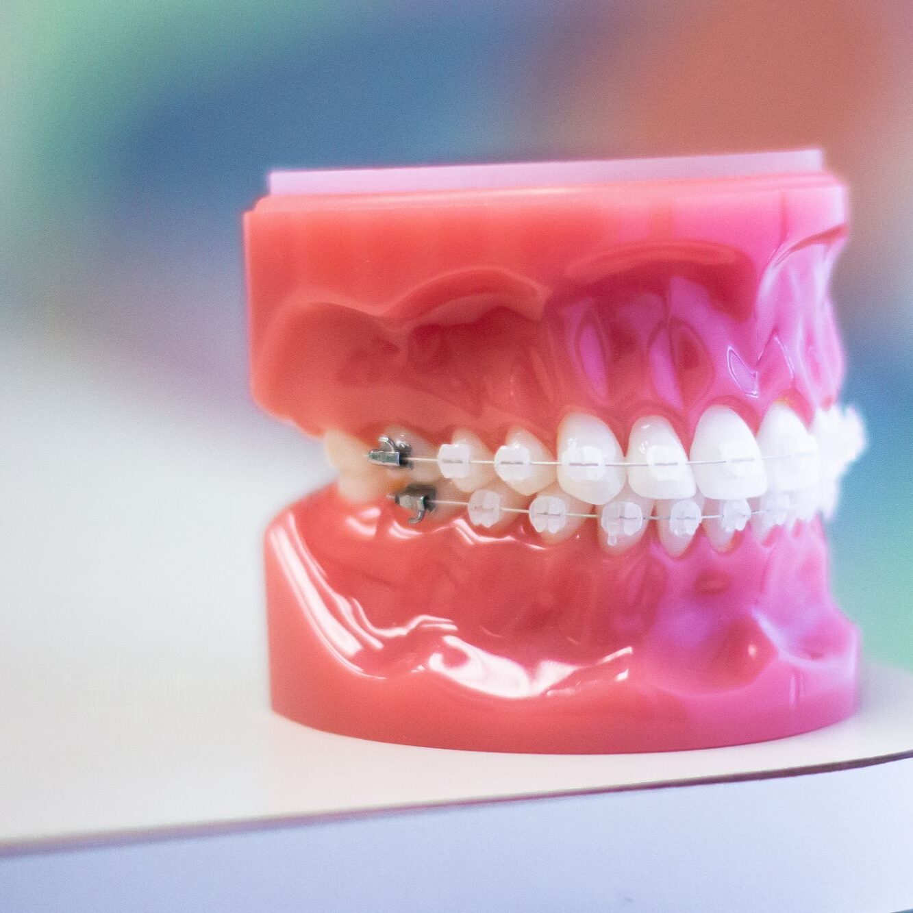 new braunfels braces